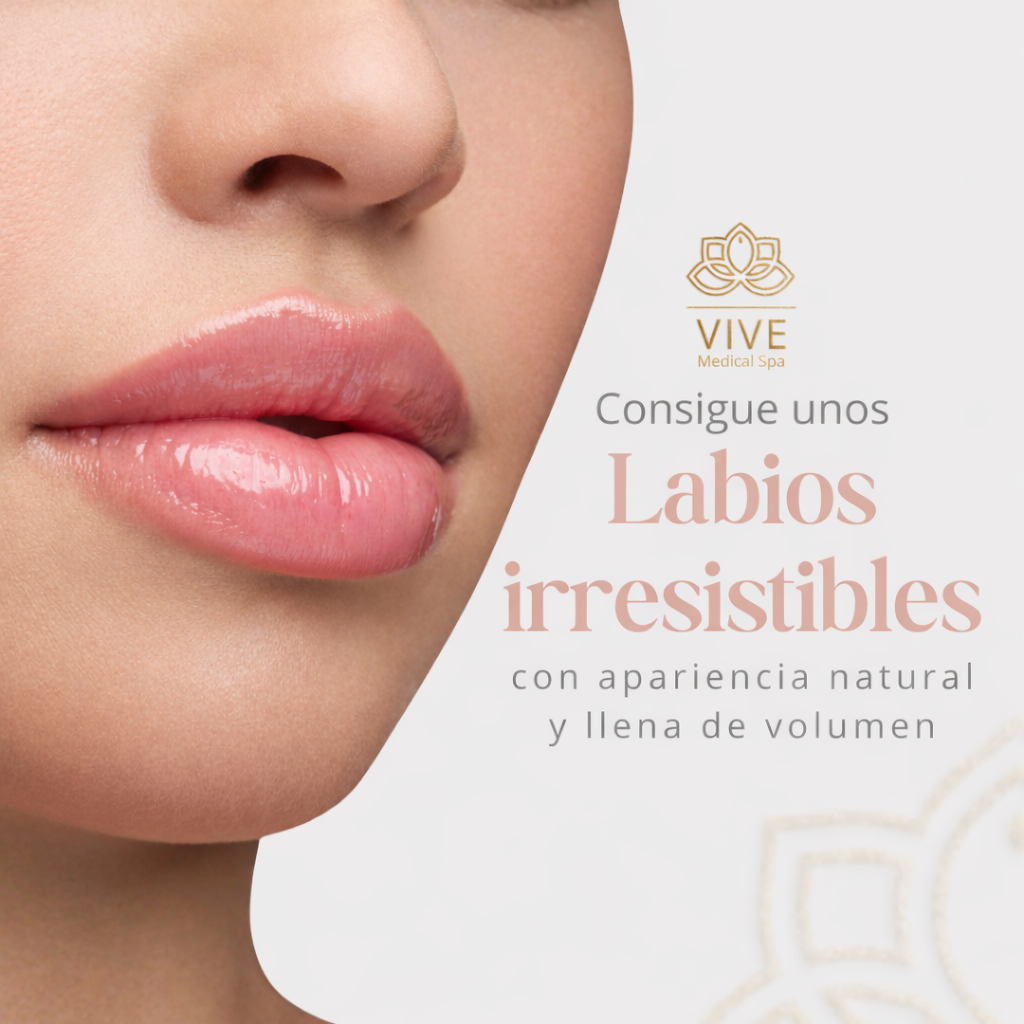 Tratamiento Lip Fillers en Cancún